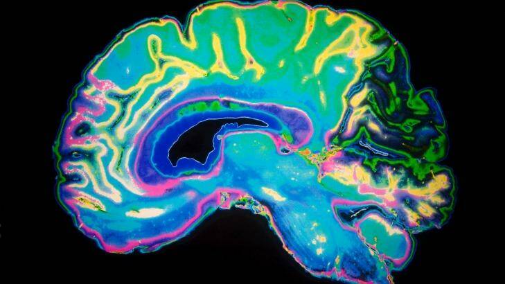 Scientists have discovered how drugs could attack abnormal "plaques" in the brain. 