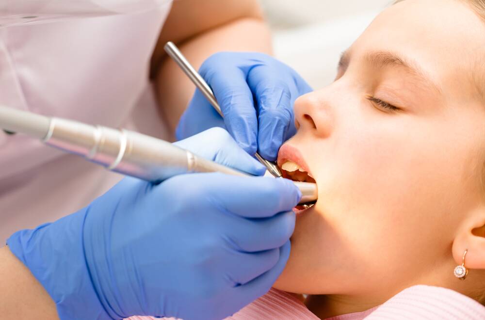 How to prepare for wisdom teeth extraction