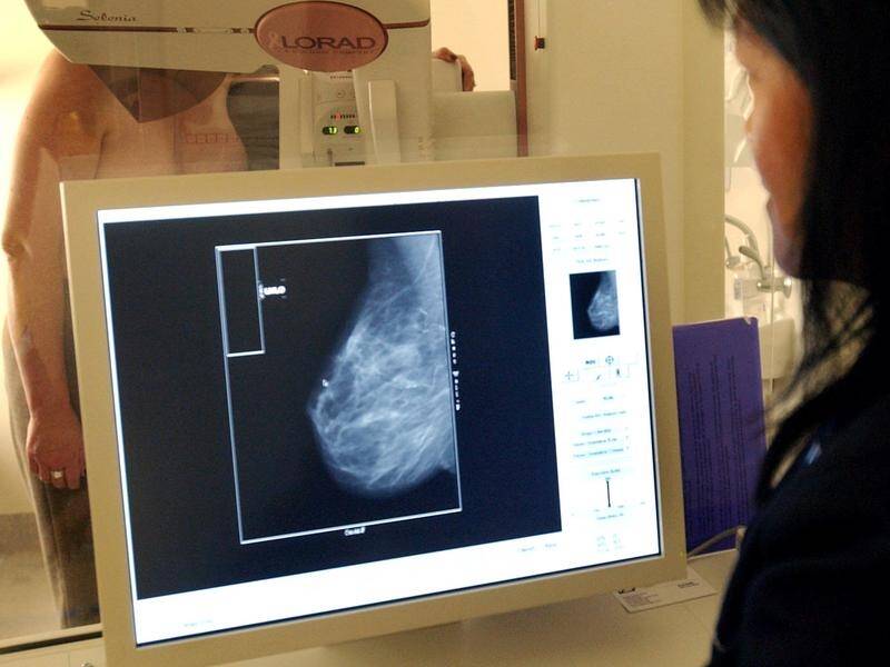 AI has the potential to improve the accuracy of breast cancer screening, a study has shown.
